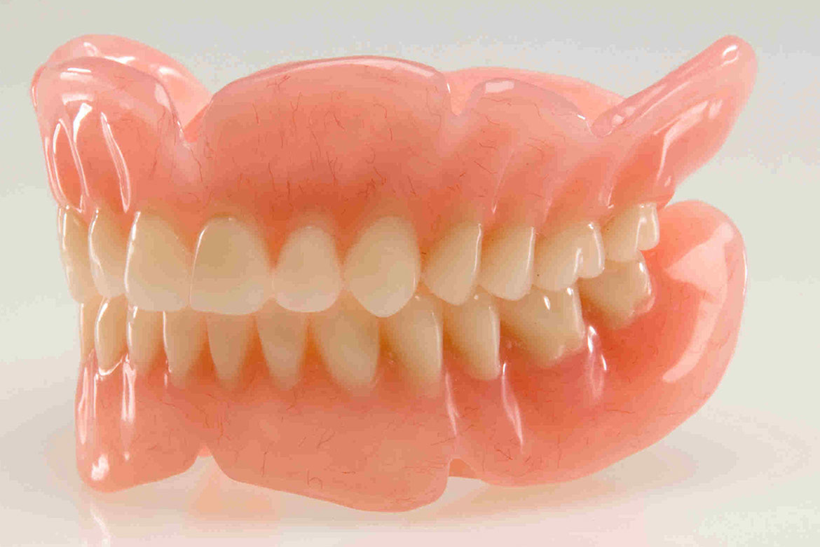 Răng giả tháo lắp tiện dụng