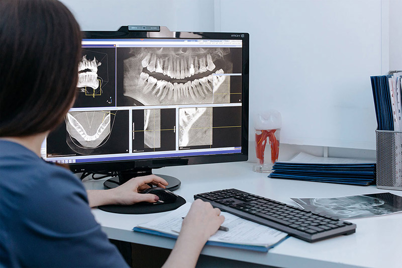 Trồng răng implant l&agrave; một quy tr&igrave;nh phức tạp