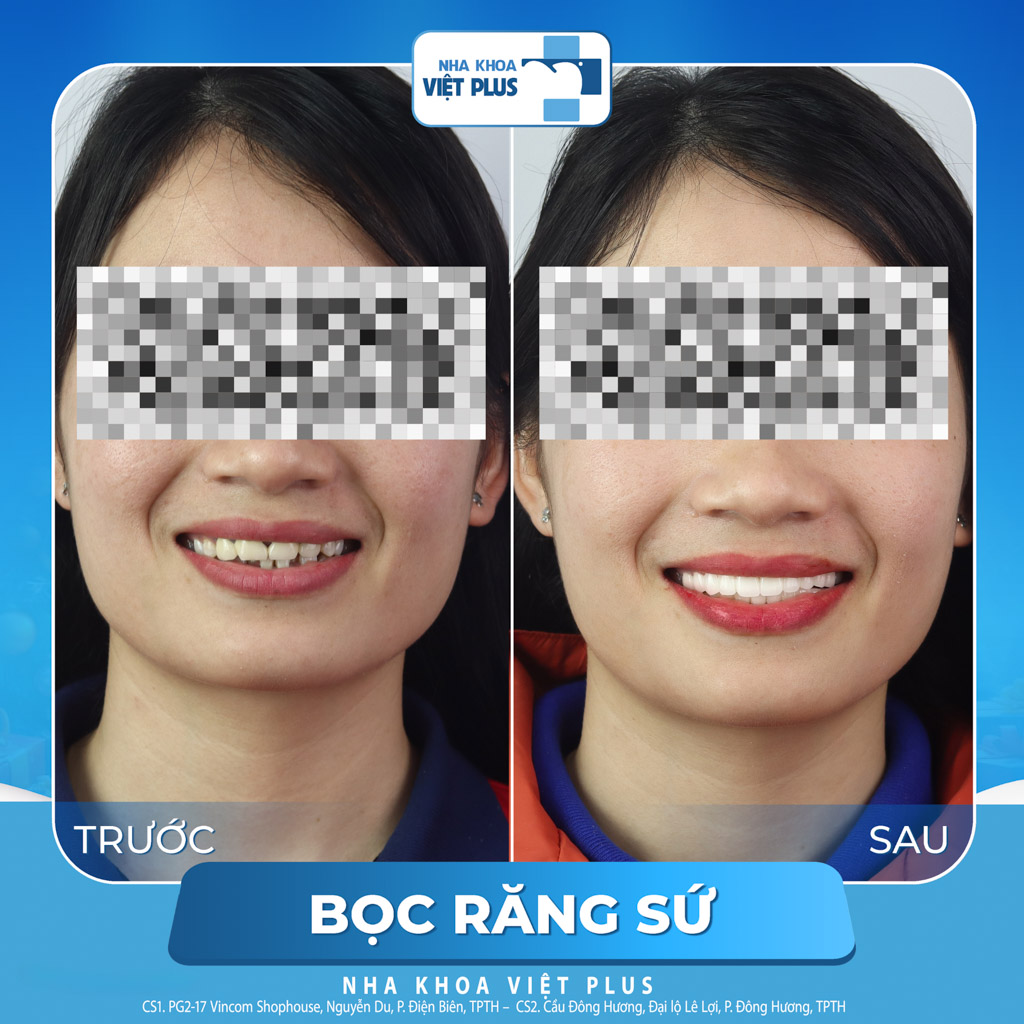 review=khach-hang-yen-nguyen-8