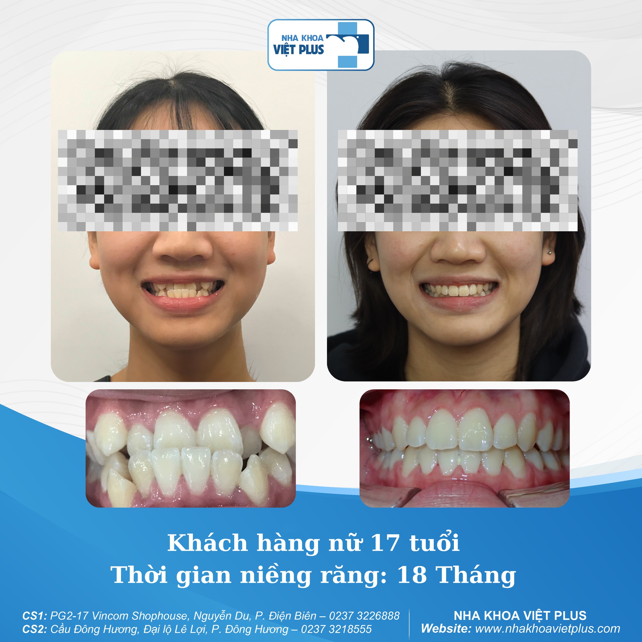 review=khach-hang-yen-nguyen-8