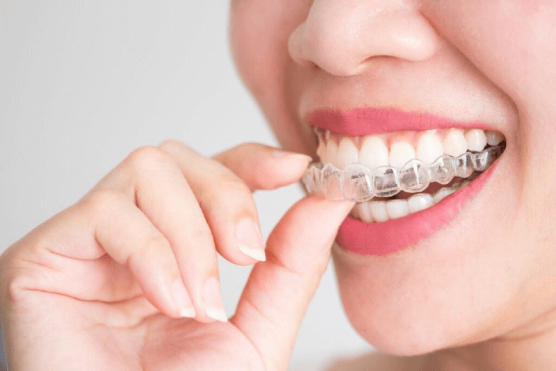 Does Invisalign Work Dentist Doncaster East 1024x683 1