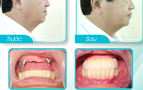 review=khach-hang-yen-nguyen-8