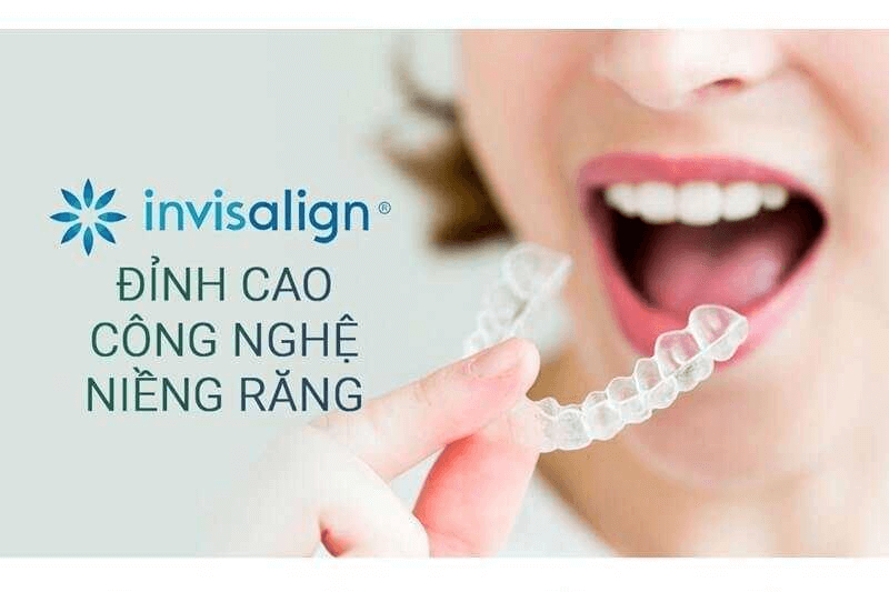 nieng rang invisalign o dau tot 4 1