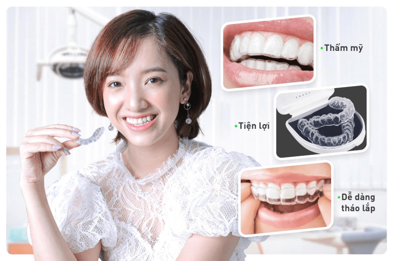uu nhuoc diem nieng invisalign 1