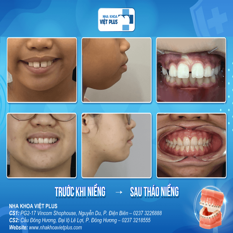 ph&ograve;ng kh&aacute;m nha khoa tại thanh h&oacute;a 