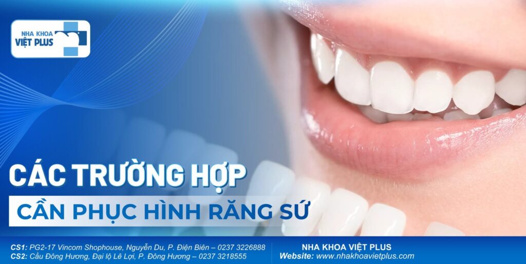 Các trường hợp cần phục hình răng sứ 1 phục hình răng sứ