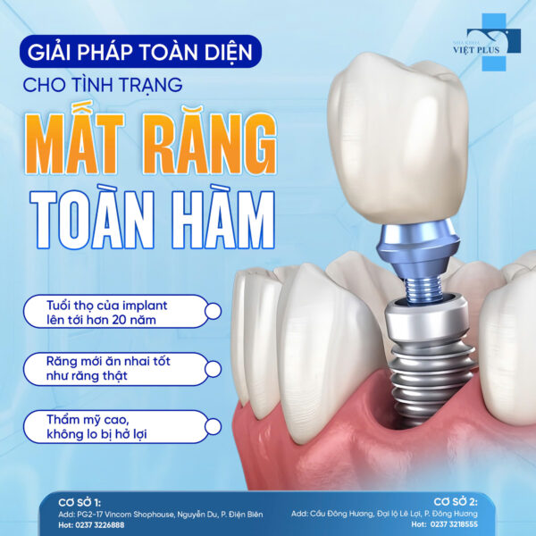MẤT RĂNG TOÀN HÀM - LÀM SAO ĐỂ PHỤC HỒI CHỨC NĂNG TỐT NHẤT? - 1 5 460