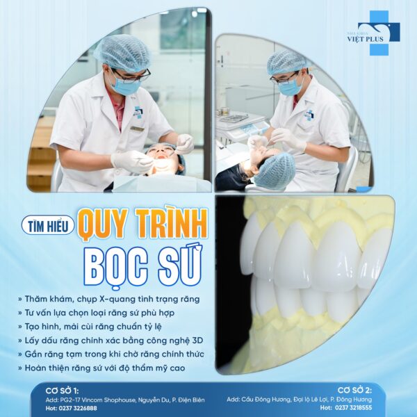 BỌC RĂNG SỨ - THAY ĐỔI NỤ CƯỜI CHỈ SAU 3 NGÀY 2 bocsu0
