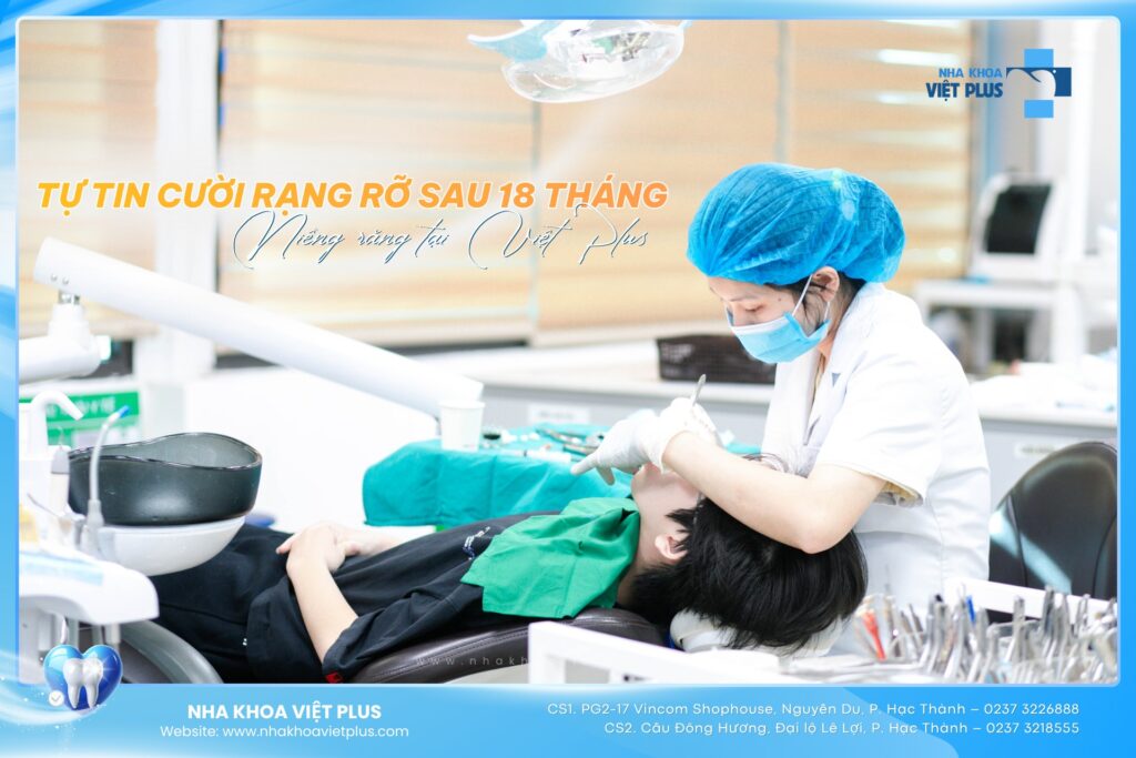NIỀNG RĂNG